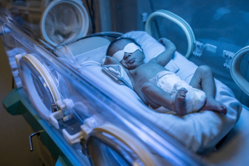 treating jaundice in babies