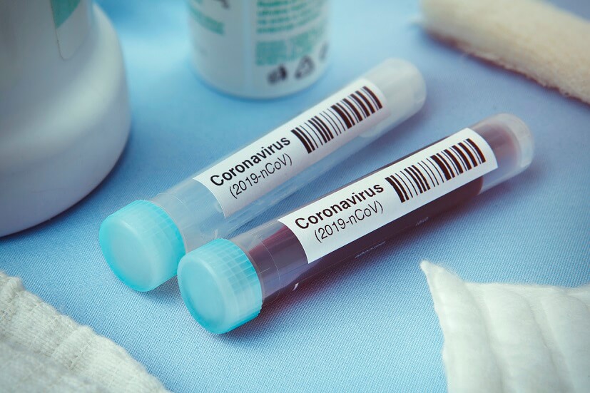 Our plans offer your coverage against COVID-19.